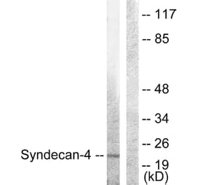 Western Blot - Anti-Syndecan4 Antibody (B1010) - Antibodies.com