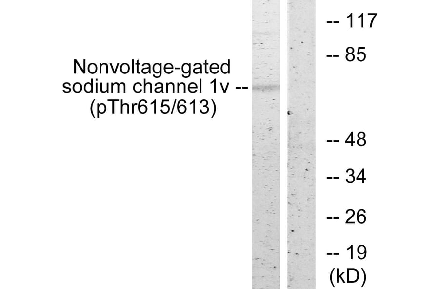Western Blot - Anti-Nonvoltage-gated Sodium Channel 1 (phospho Thr615) Antibody (A1107) - Antibodies.com