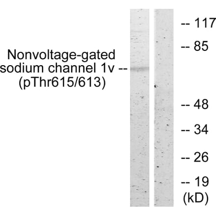 Western Blot - Anti-Nonvoltage-gated Sodium Channel 1 (phospho Thr615) Antibody (A1107) - Antibodies.com