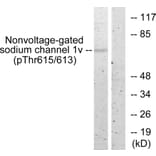 Western Blot - Anti-Nonvoltage-gated Sodium Channel 1 (phospho Thr615) Antibody (A1107) - Antibodies.com