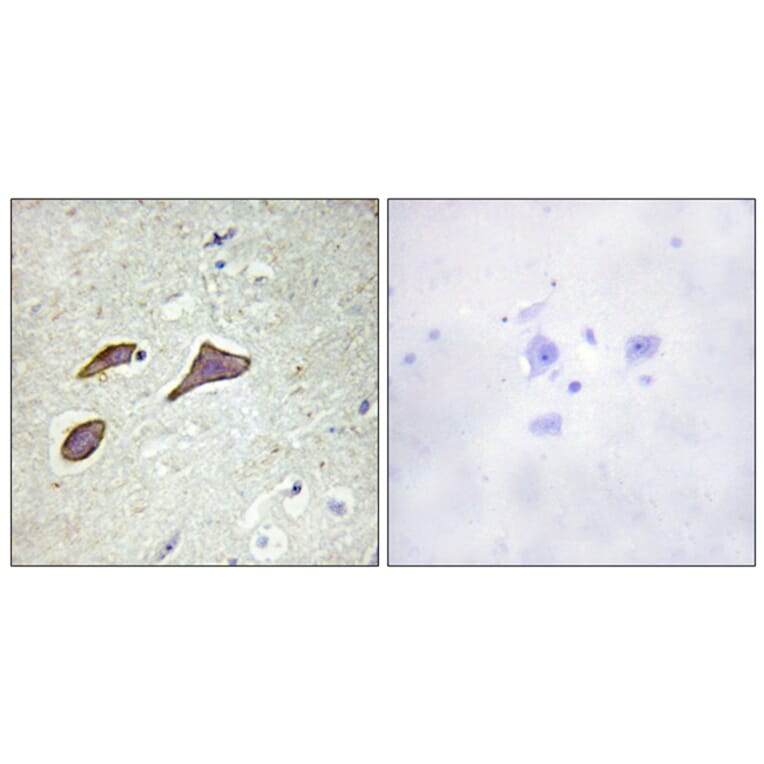 Immunohistochemistry - Anti-Nonvoltage-gated Sodium Channel 1 (phospho Thr615) Antibody (A1107) - Antibodies.com