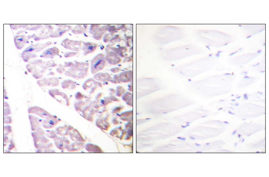 Immunohistochemistry - Anti-IKK alpha (phospho Ser176) + IKK beta (phospho Ser177) Antibody (A0441) - Antibodies.com
