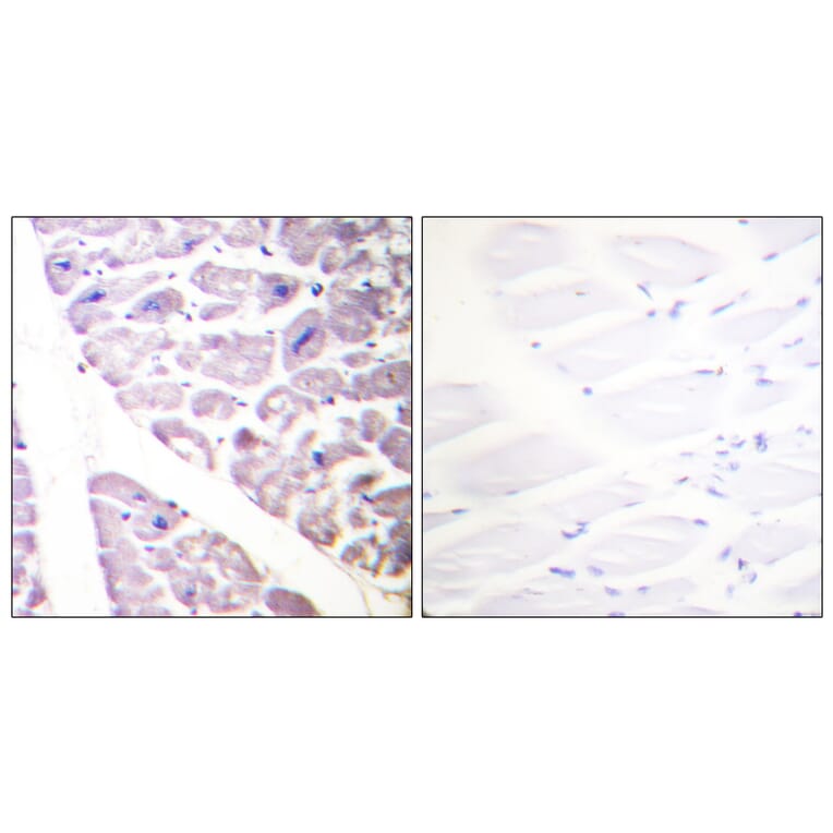 Immunohistochemistry - Anti-IKK alpha (phospho Ser176) + IKK beta (phospho Ser177) Antibody (A0441) - Antibodies.com