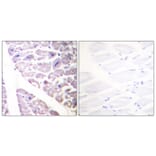 Immunohistochemistry - Anti-IKK alpha (phospho Ser176) + IKK beta (phospho Ser177) Antibody (A0441) - Antibodies.com