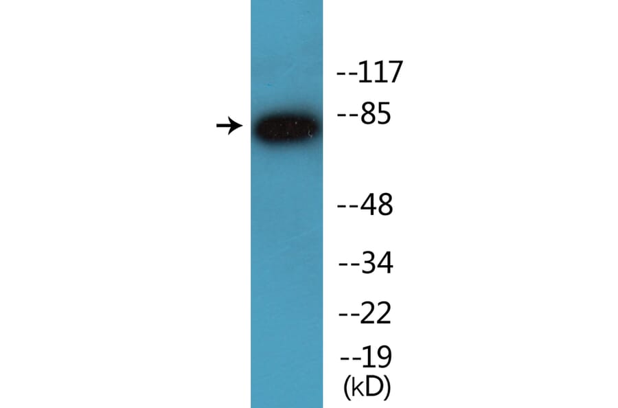 Western Blot - Anti-IKK alpha (phospho Ser176) + IKK beta (phospho Ser177) Antibody (P12-1120) - Antibodies.com