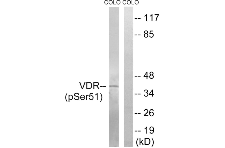 Western Blot - Anti-Vitamin D3 Receptor (phospho Ser51) Antibody (A8205) - Antibodies.com