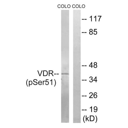 Western Blot - Anti-Vitamin D3 Receptor (phospho Ser51) Antibody (A8205) - Antibodies.com