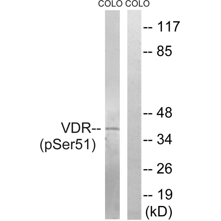 Western Blot - Anti-Vitamin D3 Receptor (phospho Ser51) Antibody (A8205) - Antibodies.com