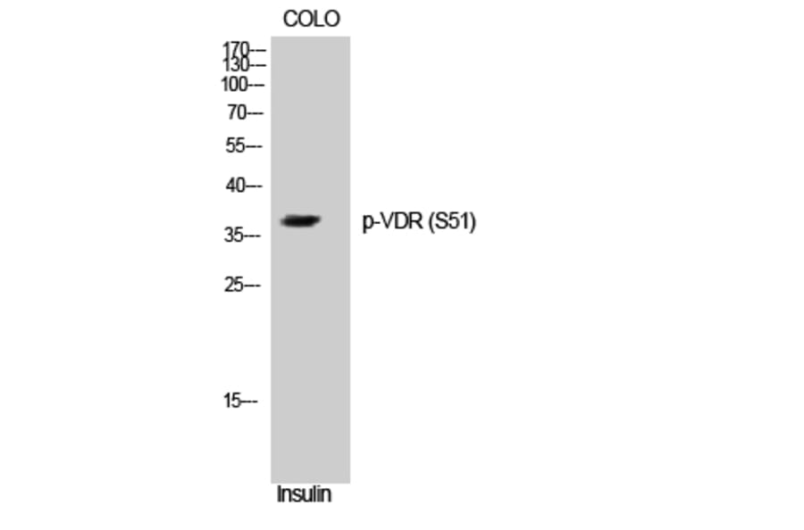 Western Blot - Anti-Vitamin D3 Receptor (phospho Ser51) Antibody (A8205) - Antibodies.com