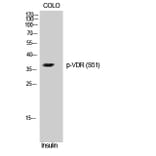 Western Blot - Anti-Vitamin D3 Receptor (phospho Ser51) Antibody (A8205) - Antibodies.com