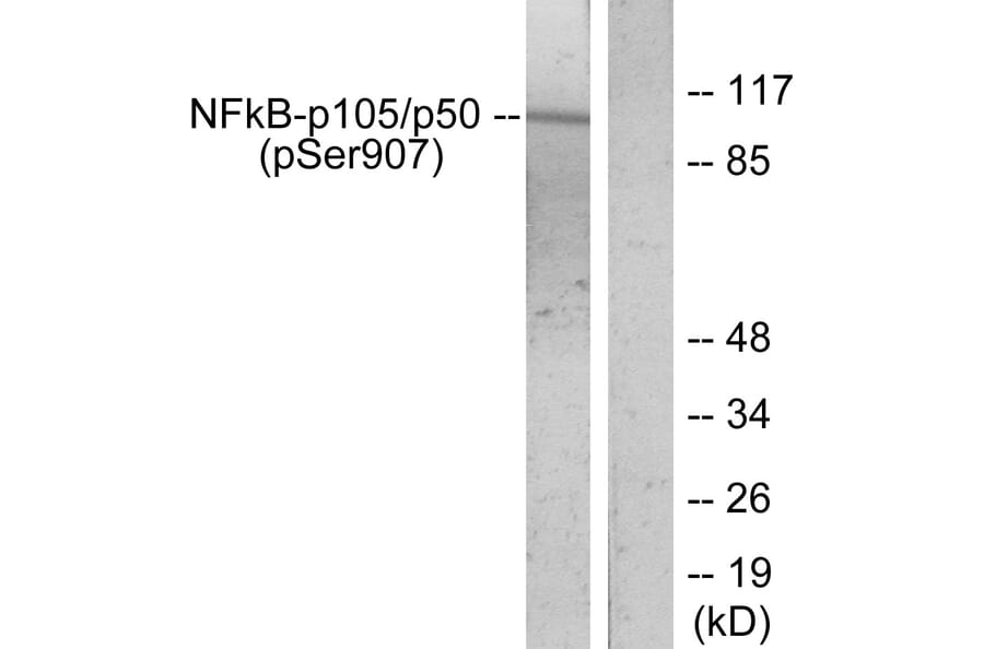 Western Blot - Anti-NF kappa B p105 / p50 (phospho Ser907) Antibody (A7168) - Antibodies.com