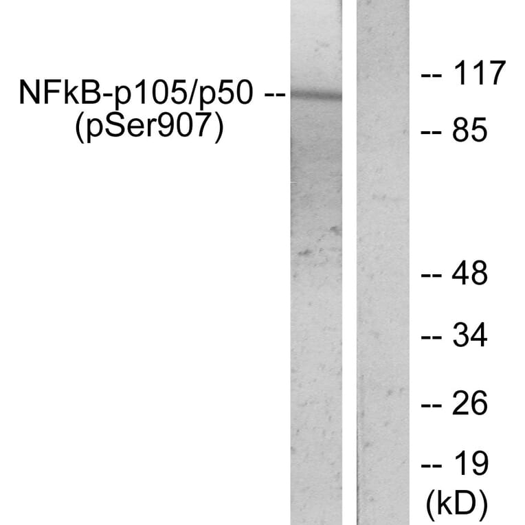 Western Blot - Anti-NF kappa B p105 / p50 (phospho Ser907) Antibody (A7168) - Antibodies.com