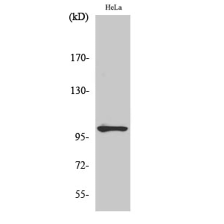 Western Blot - Anti-NF kappa B p105 / p50 (phospho Ser907) Antibody (A7168) - Antibodies.com