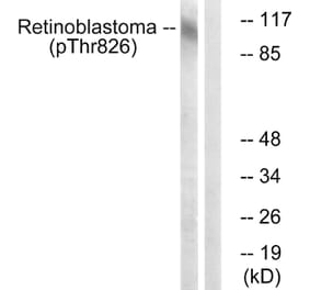 Western Blot - Anti-Retinoblastoma (phospho Thr826) Antibody (A0984) - Antibodies.com