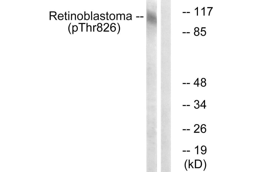 Western Blot - Anti-Retinoblastoma (phospho Thr826) Antibody (A0984) - Antibodies.com
