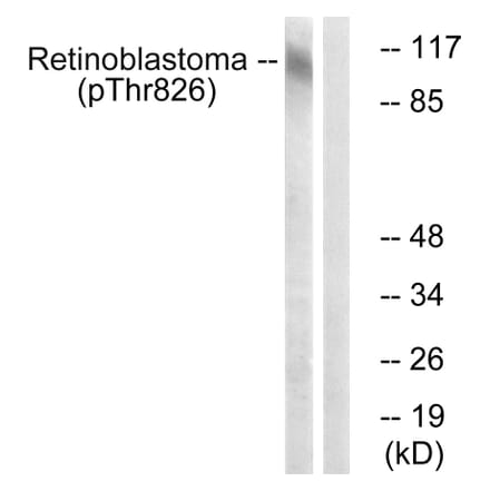 Western Blot - Anti-Retinoblastoma (phospho Thr826) Antibody (A0984) - Antibodies.com