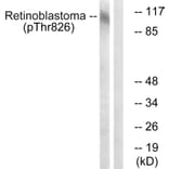 Western Blot - Anti-Retinoblastoma (phospho Thr826) Antibody (A0984) - Antibodies.com