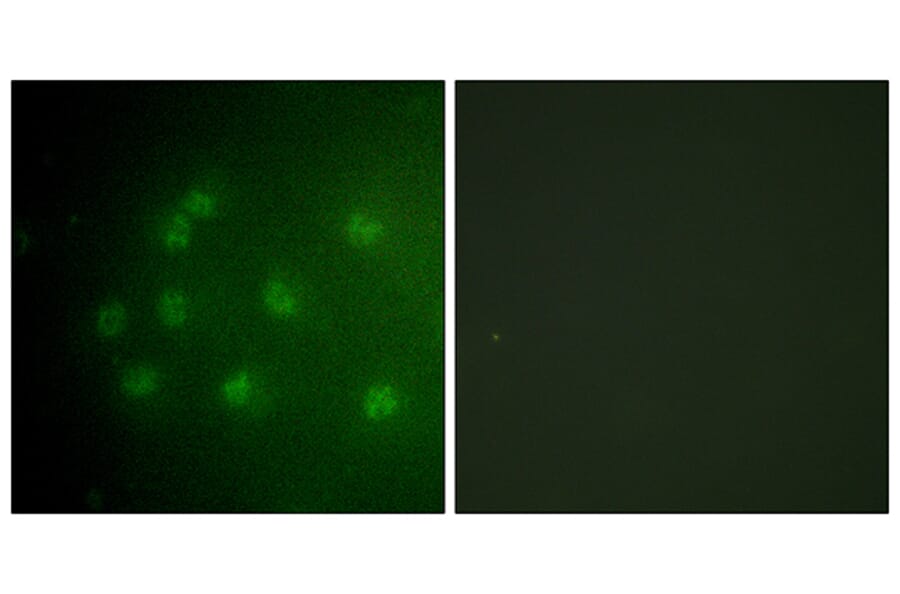 Immunofluorescence - Anti-Retinoblastoma (phospho Thr826) Antibody (A0984) - Antibodies.com