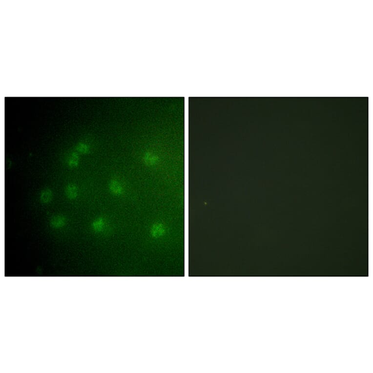 Immunofluorescence - Anti-Retinoblastoma (phospho Thr826) Antibody (A0984) - Antibodies.com