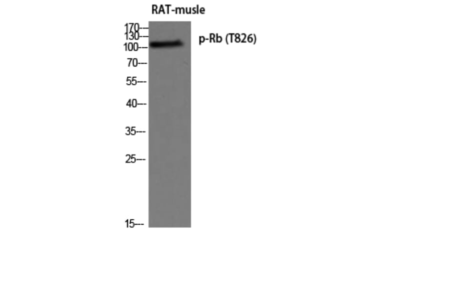 Western Blot - Anti-Retinoblastoma (phospho Thr826) Antibody (A0984) - Antibodies.com