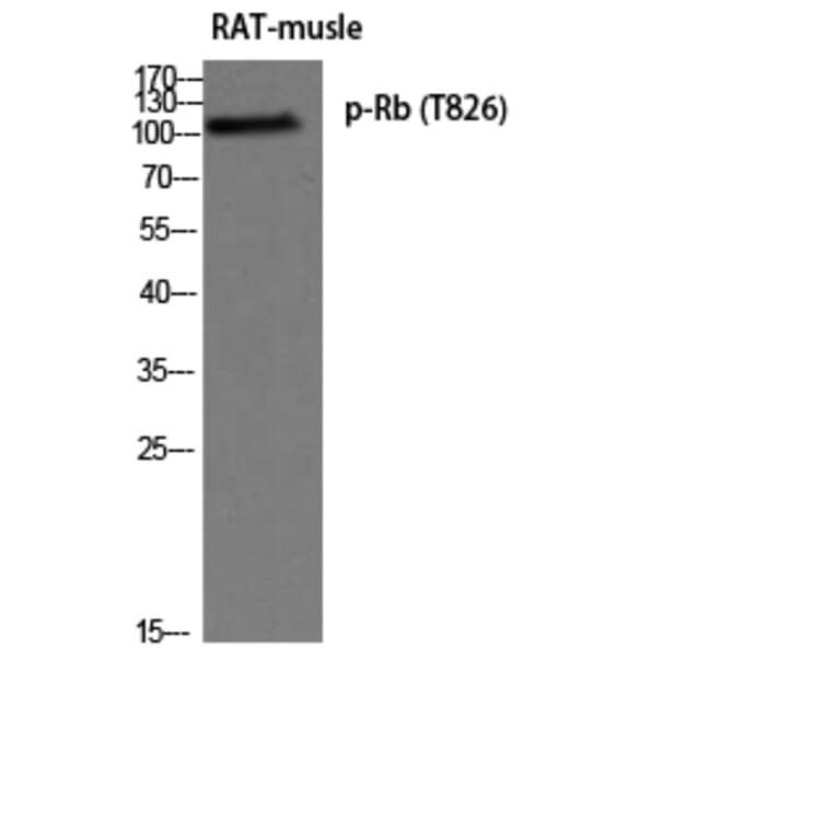 Western Blot - Anti-Retinoblastoma (phospho Thr826) Antibody (A0984) - Antibodies.com