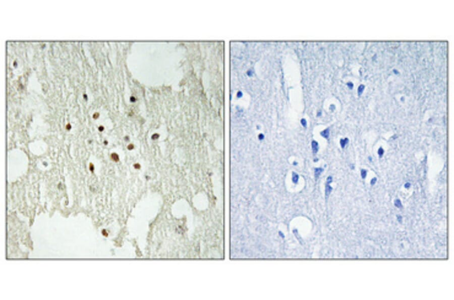 Immunohistochemistry - Anti-Retinoblastoma (phospho Thr826) Antibody (A0984) - Antibodies.com