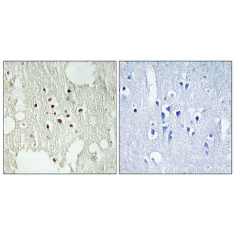 Immunohistochemistry - Anti-Retinoblastoma (phospho Thr826) Antibody (A0984) - Antibodies.com