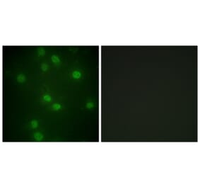 Immunofluorescence - Anti-Retinoblastoma (phospho Ser811) Antibody (A0810) - Antibodies.com
