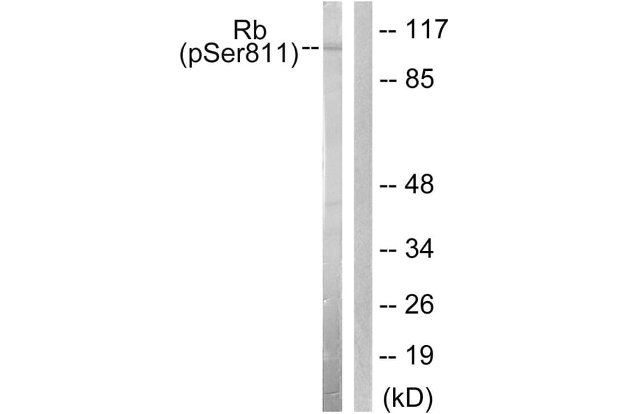 Western Blot - Anti-Retinoblastoma (phospho Ser811) Antibody (A0810) - Antibodies.com