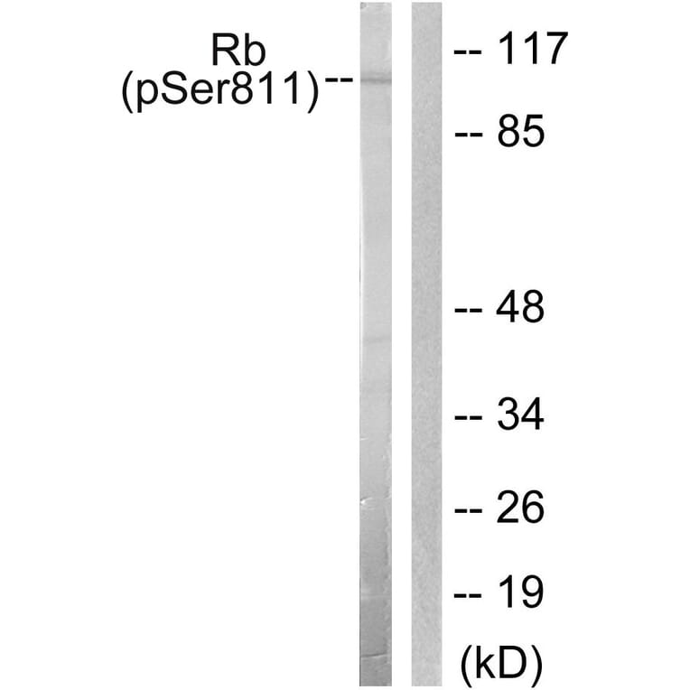 Western Blot - Anti-Retinoblastoma (phospho Ser811) Antibody (A0810) - Antibodies.com