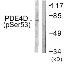 Western Blot - Anti-PDE4D (phospho Ser190 + Ser53) Antibody (A0543) - Antibodies.com
