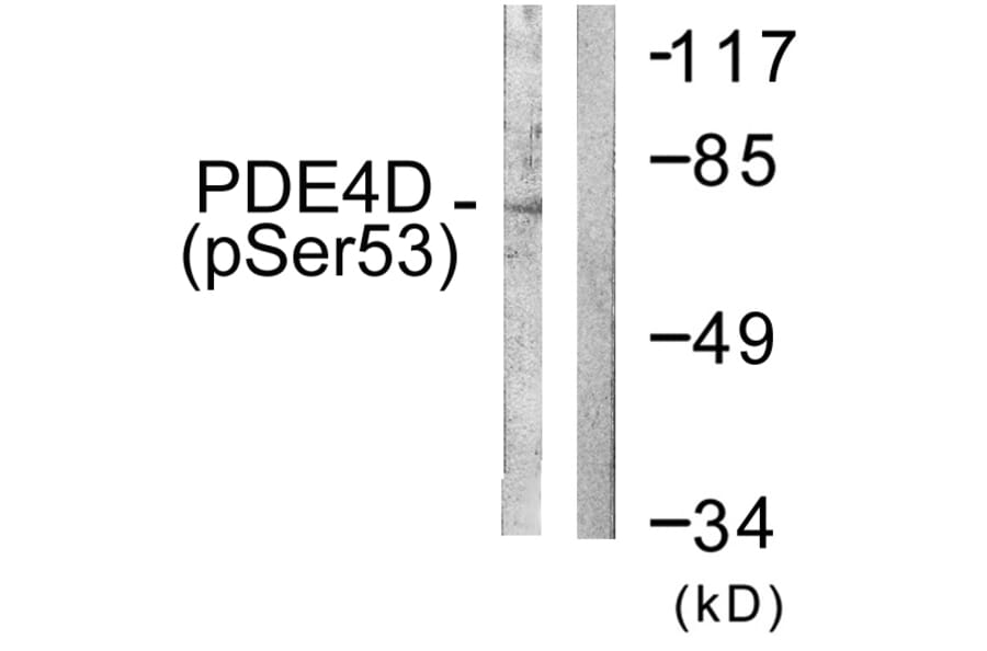 Western Blot - Anti-PDE4D (phospho Ser190 + Ser53) Antibody (A0543) - Antibodies.com