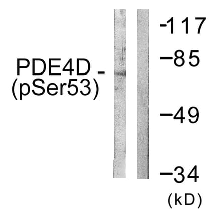 Western Blot - Anti-PDE4D (phospho Ser190 + Ser53) Antibody (A0543) - Antibodies.com