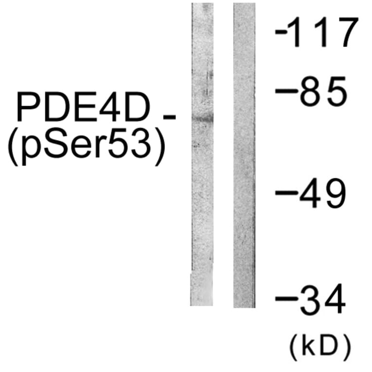 Western Blot - Anti-PDE4D (phospho Ser190 + Ser53) Antibody (A0543) - Antibodies.com