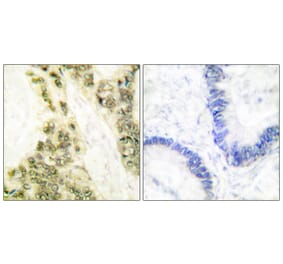 Immunohistochemistry - Anti-Thyroid Hormone Receptor alpha Antibody (C0345) - Antibodies.com