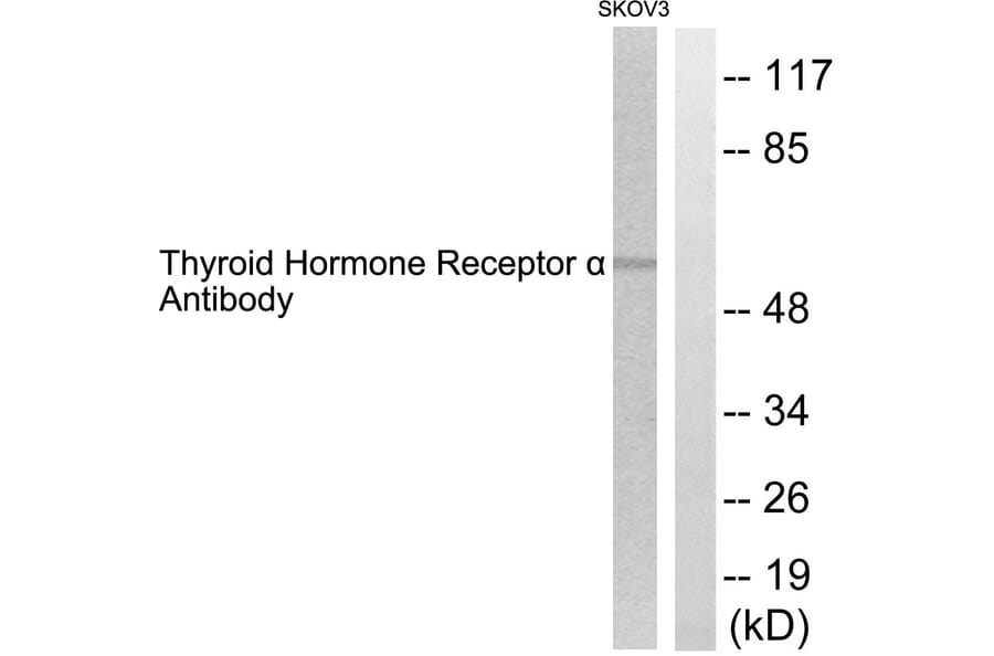 Anti-Thyroid Hormone Receptor alpha Antibody (A94561) | Antibodies.com