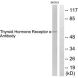 Western Blot - Anti-Thyroid Hormone Receptor alpha Antibody (C0345) - Antibodies.com