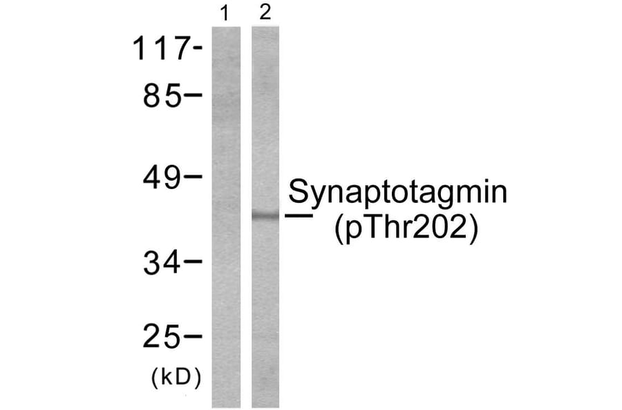 Western Blot - Anti-Synaptotagmin (phospho Thr202) Antibody (A0033) - Antibodies.com