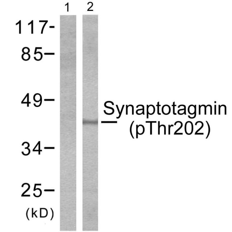 Western Blot - Anti-Synaptotagmin (phospho Thr202) Antibody (A0033) - Antibodies.com