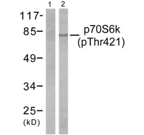 Western Blot - Anti-p70 S6 Kinase (phospho Thr421) Antibody (A7190) - Antibodies.com