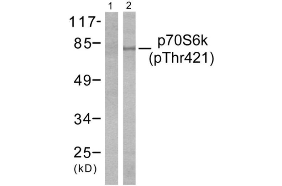 Western Blot - Anti-p70 S6 Kinase (phospho Thr421) Antibody (A7190) - Antibodies.com
