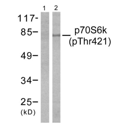 Western Blot - Anti-p70 S6 Kinase (phospho Thr421) Antibody (A7190) - Antibodies.com