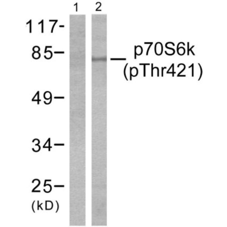 Western Blot - Anti-p70 S6 Kinase (phospho Thr421) Antibody (A7190) - Antibodies.com
