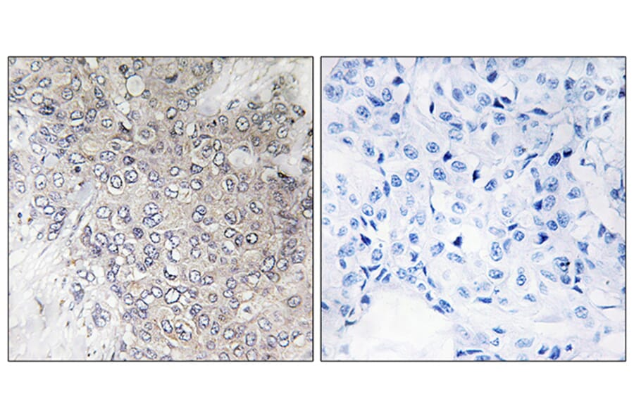 Immunohistochemistry - Anti-p70 S6 Kinase (phospho Thr421) Antibody (A7190) - Antibodies.com