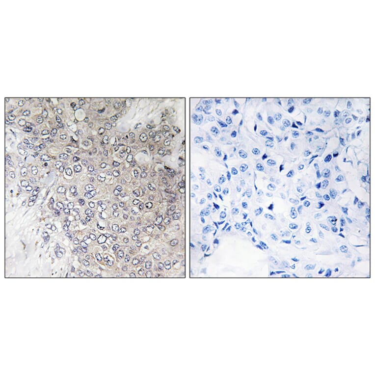 Immunohistochemistry - Anti-p70 S6 Kinase (phospho Thr421) Antibody (A7190) - Antibodies.com
