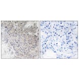 Immunohistochemistry - Anti-p70 S6 Kinase (phospho Thr421) Antibody (A7190) - Antibodies.com