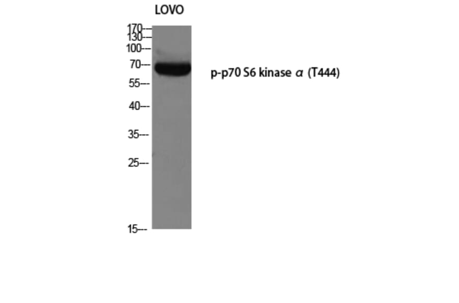 Western Blot - Anti-p70 S6 Kinase (phospho Thr421) Antibody (A7190) - Antibodies.com