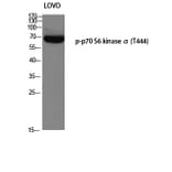 Western Blot - Anti-p70 S6 Kinase (phospho Thr421) Antibody (A7190) - Antibodies.com