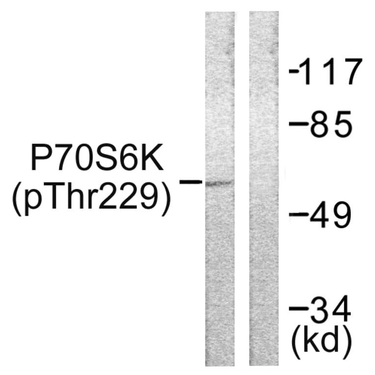 Western Blot - Anti-p70 S6 Kinase (phospho Thr229) Antibody (A0531) - Antibodies.com