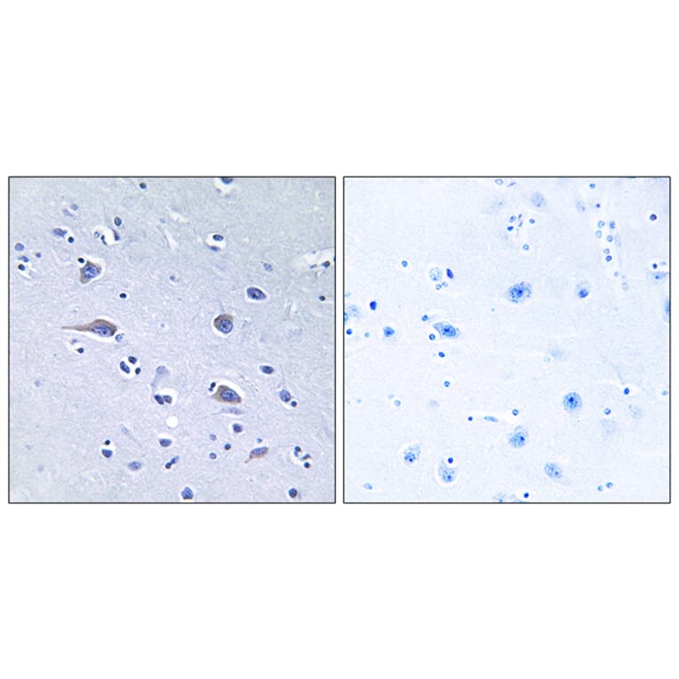Immunohistochemistry - Anti-p70 S6 Kinase (phospho Thr229) Antibody (A0531) - Antibodies.com